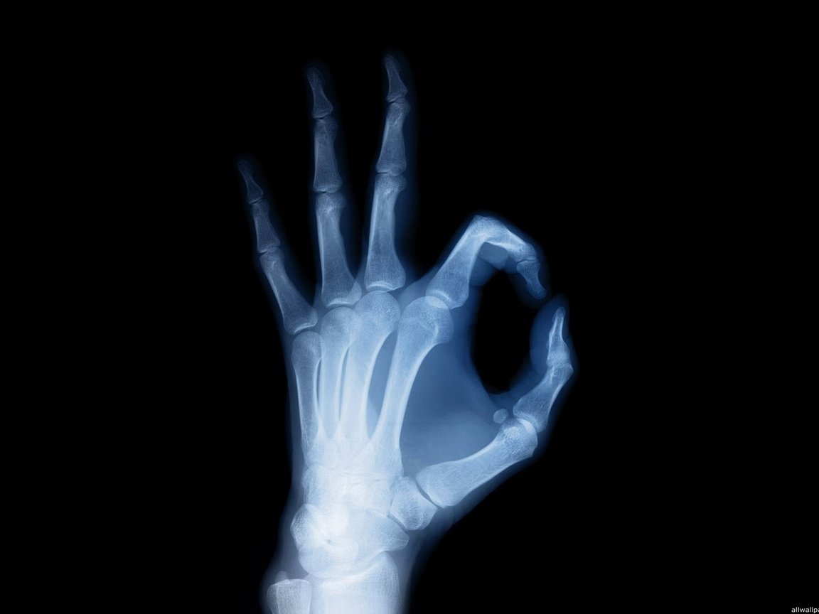 Обои рука, черный фон, рентген, кости, скелет, ок, hand, black background, x-ray, bones, skeleton, ok разрешение 1920x1200 Загрузить