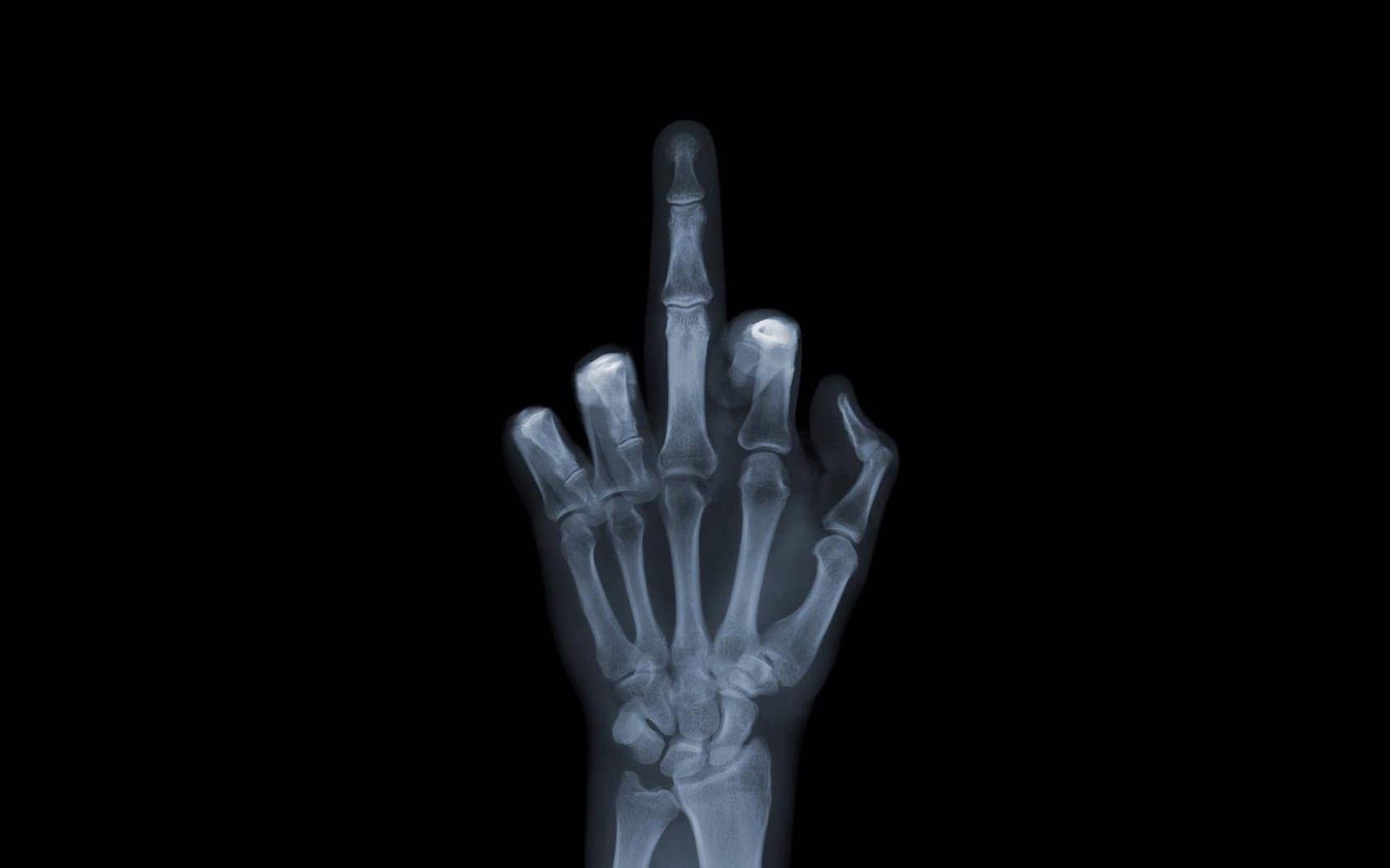 Обои обои, рука, снимок, рентген, кости, fuck you, фак ю, валлпапер, wallpaper, hand, the, x-ray, bones, fuck u разрешение 1920x1080 Загрузить