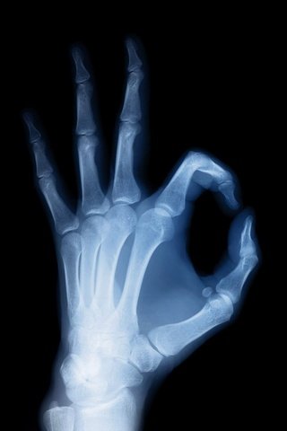 Обои рука, черный фон, рентген, кости, скелет, ок, hand, black background, x-ray, bones, skeleton, ok разрешение 1920x1200 Загрузить