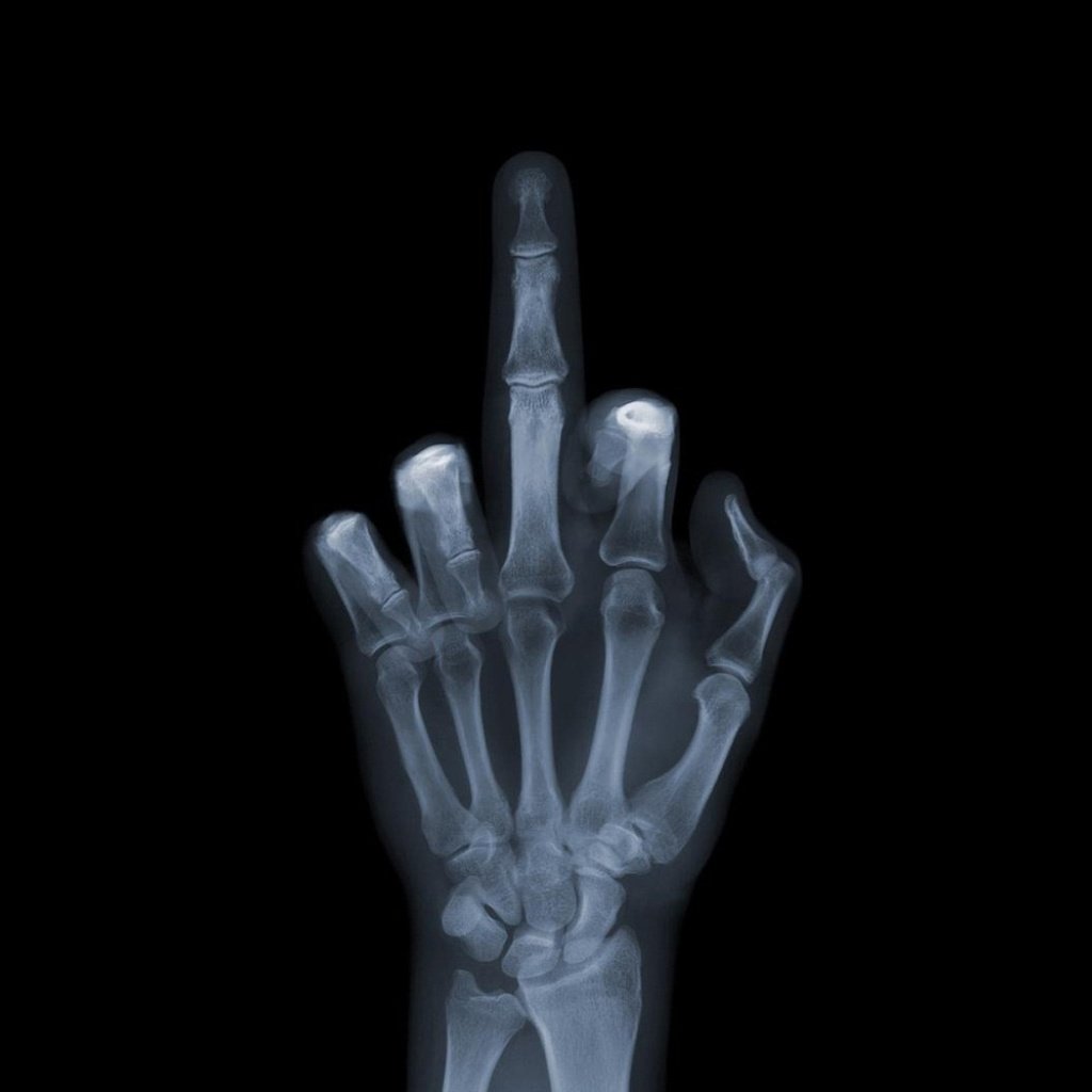 Обои обои, рука, снимок, рентген, кости, fuck you, фак ю, валлпапер, wallpaper, hand, the, x-ray, bones, fuck u разрешение 1920x1080 Загрузить