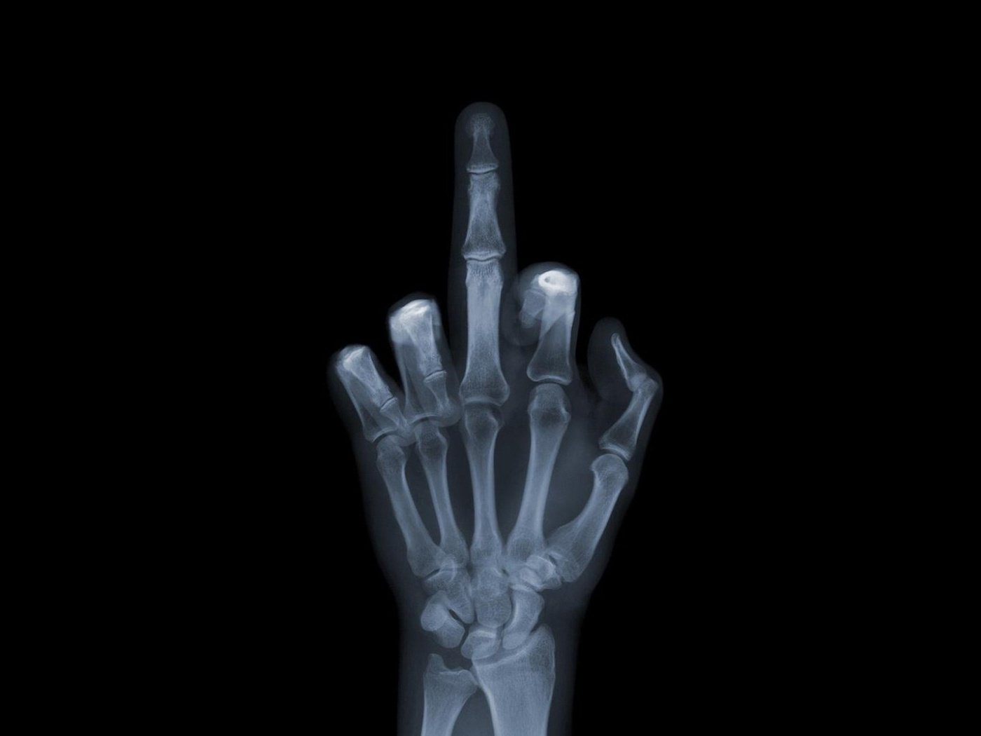 Обои обои, рука, снимок, рентген, кости, fuck you, фак ю, валлпапер, wallpaper, hand, the, x-ray, bones, fuck u разрешение 1920x1080 Загрузить