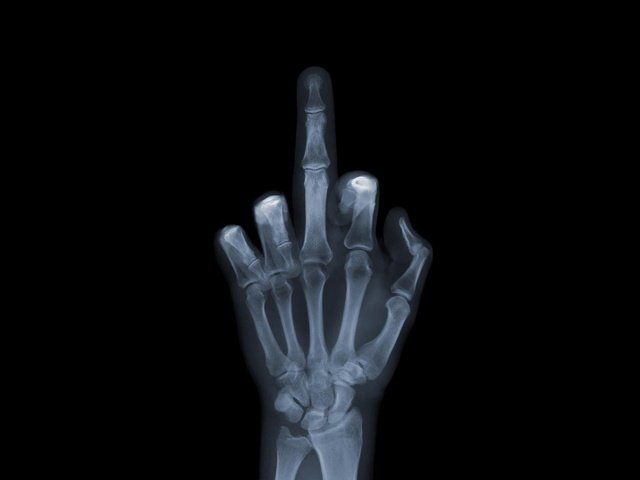 Обои обои, рука, снимок, рентген, кости, fuck you, фак ю, валлпапер, wallpaper, hand, the, x-ray, bones, fuck u разрешение 1920x1080 Загрузить