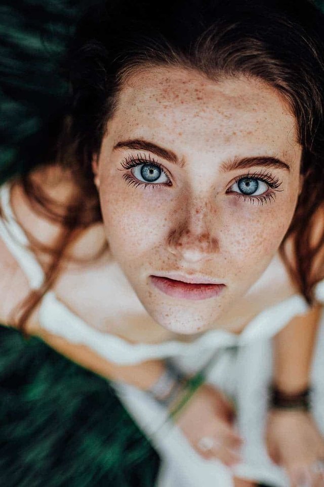 Black Teen Girls With Freckles