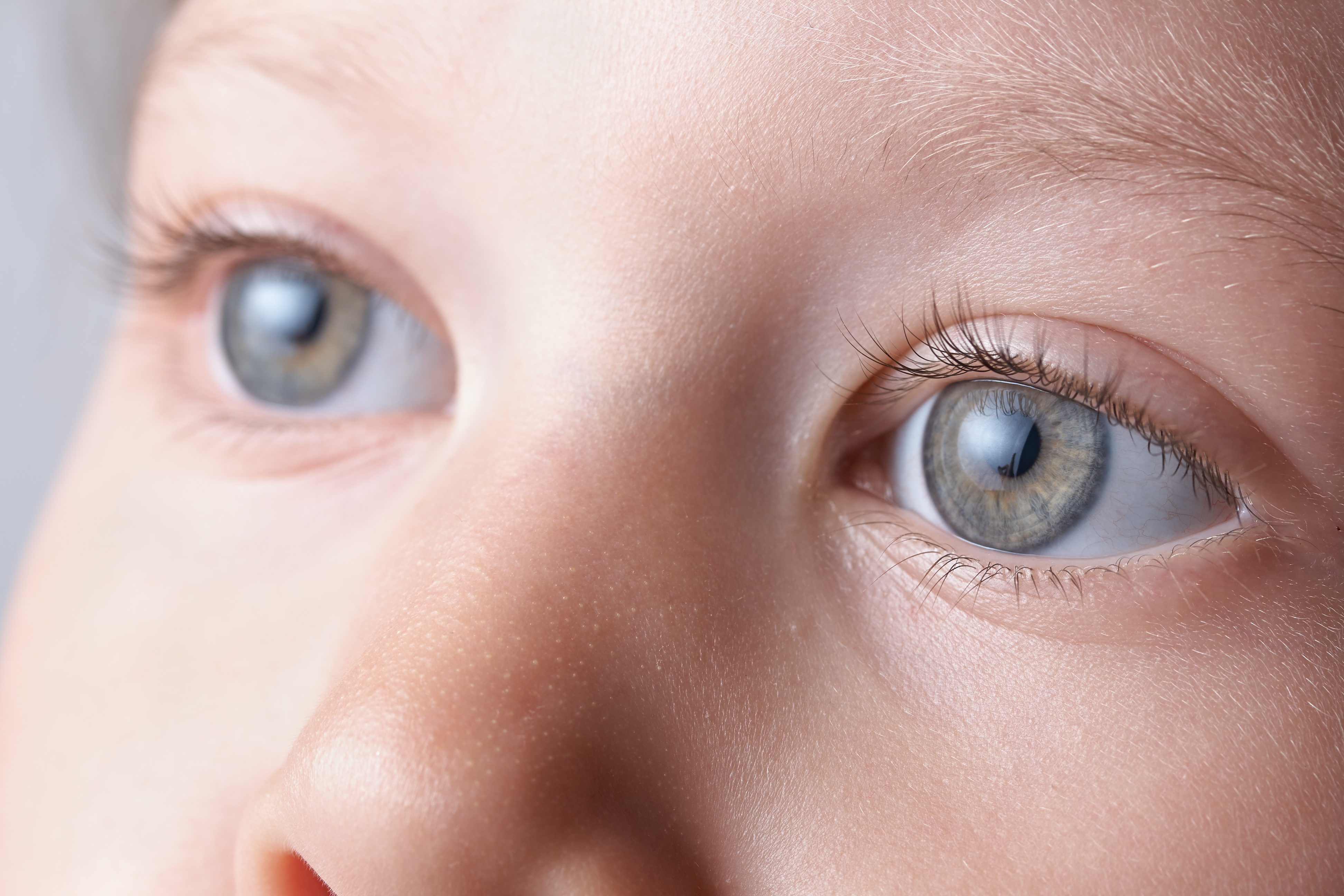 Почему у ребенка голубые глаза. Глаза ребенка. Врожденная КАТАРАКТАКАТАРАКТА.
